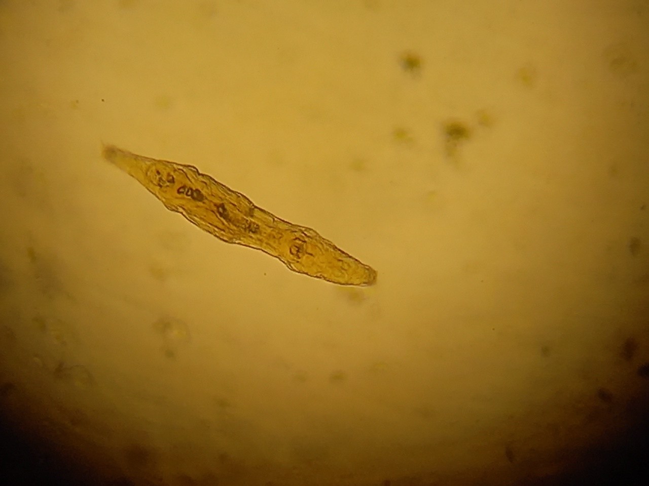 Philodinidae Philodinidae